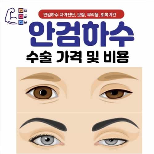 안검하수의 원인이 되는 치료 부작용, 쌍꺼풀 수술과의 차이 3