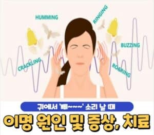 이명 원인 및 증상, 치료 방법 | 귀에서 삐 소리 들릴 때 - 건강블로그 이명 원인 및 증상, 치료 방법 | 귀에서 삐 소리 들릴 때 - 건강블로그