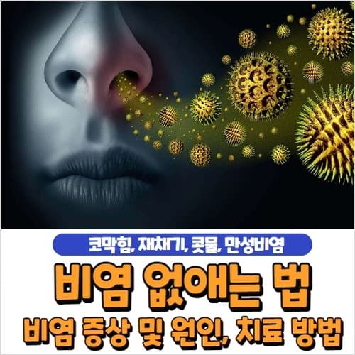 비염 없애는 법 및 치료, 증상, 자가치료