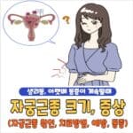 자궁근종 크기