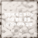 잇몸에서 피가 나는 이유 분석 | 출혈 원인과 대처 방법