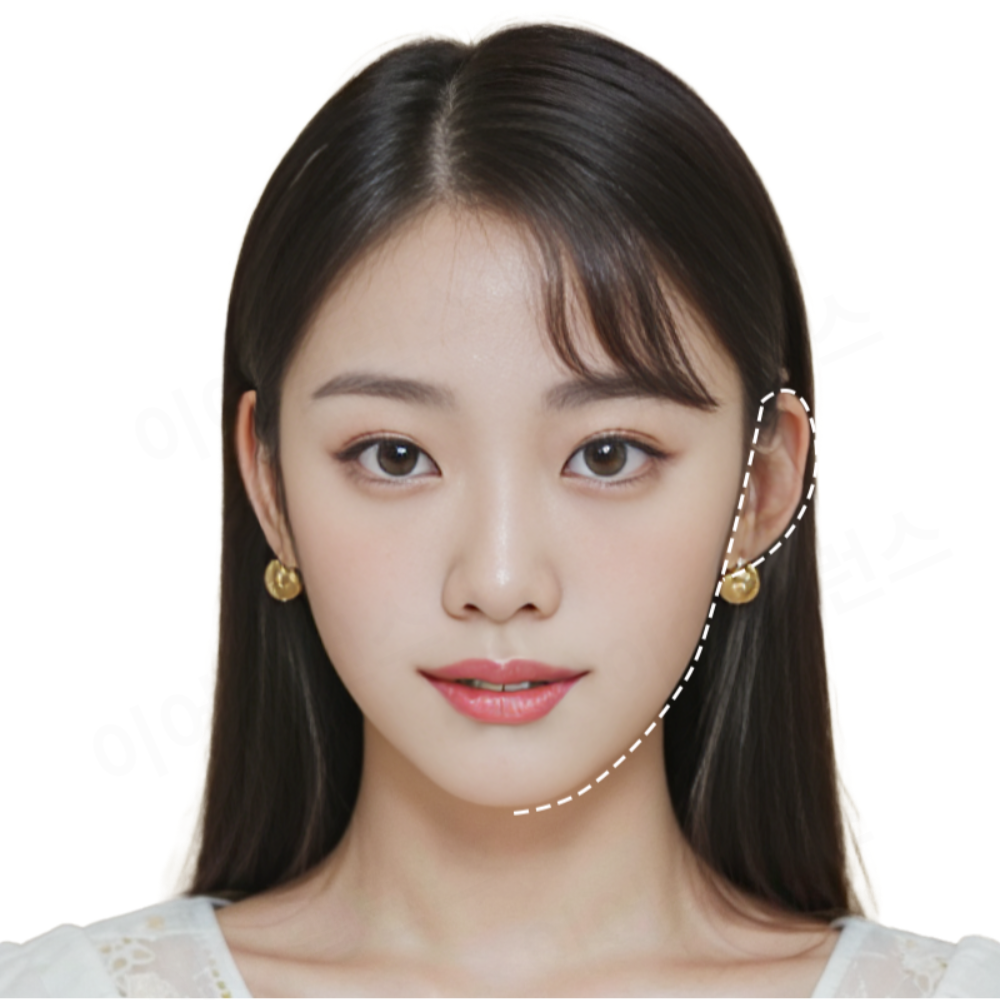 [고탄성 고밀착] 누운귀 테이프 성형 요정 엘프귀 세우는 교정 스티커 테이프 A타입(투명) 90p 상세 이미지 2